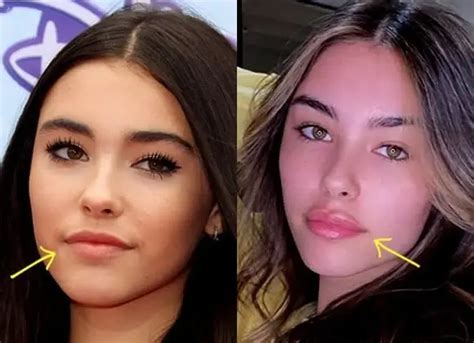 does madison beer have a boob job|Madison Beer Denies Plastic Surgery Rumors, But。